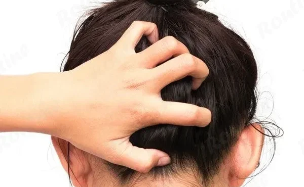 بهترین شامپو برای خارش سر